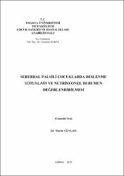 Küçük Resim